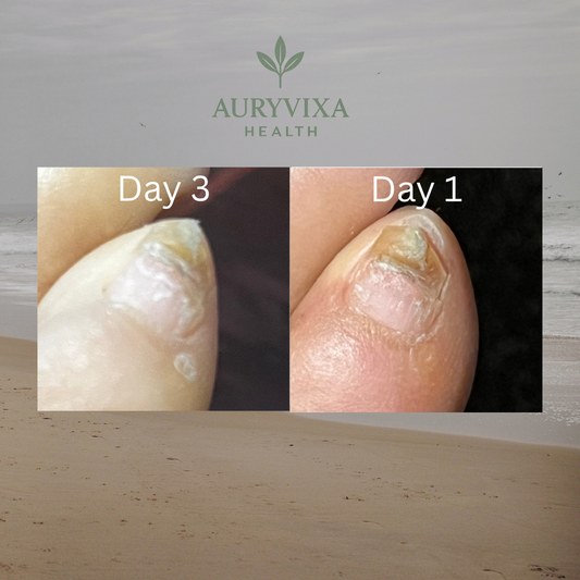 Auryvixa™ Nail Repair Patches - 60 Pack