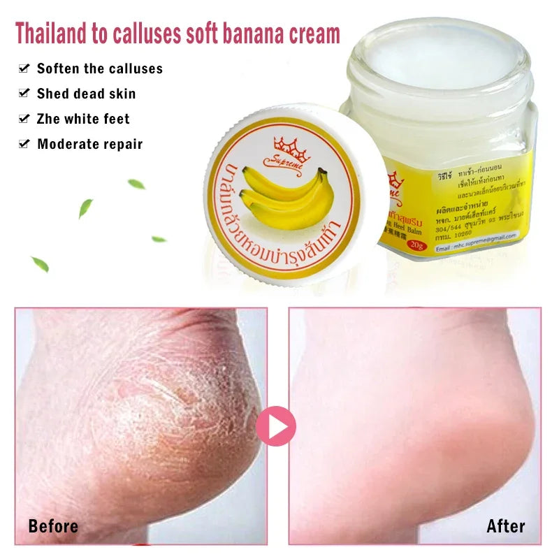 Banana Heel Repair Foot Cream – Moisturizing & Cracked Skin Healing Balm