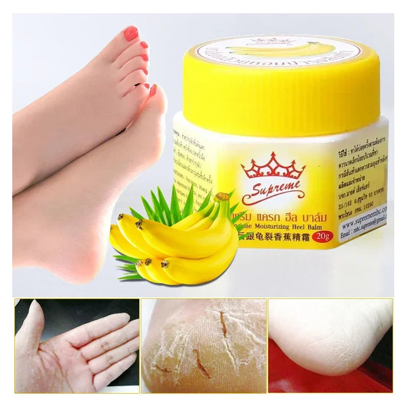Banana Heel Repair Foot Cream – Moisturizing & Cracked Skin Healing Balm