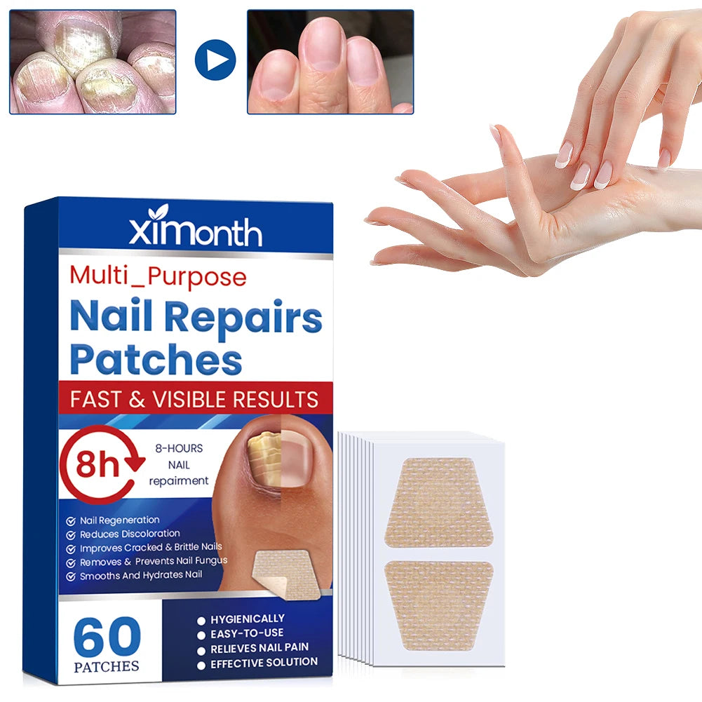 Auryvixa™ Nail Repair Patches - 60 Pack