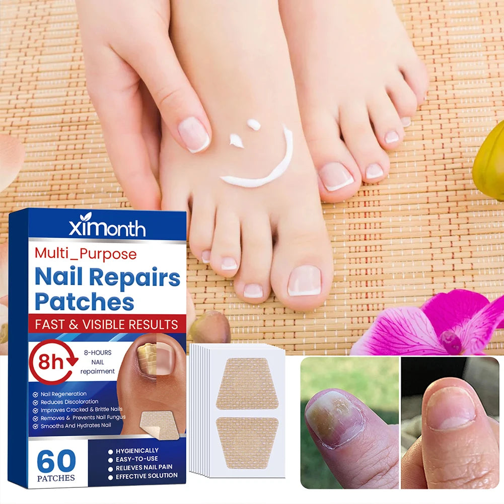 Auryvixa™ Nail Repair Patches - 60 Pack
